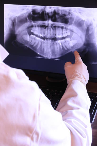 Best Emergency Tooth Extraction in Tuskegee, AL