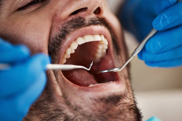 Best Emergency Dental Care for Trauma or Injury in Tuskegee, AL