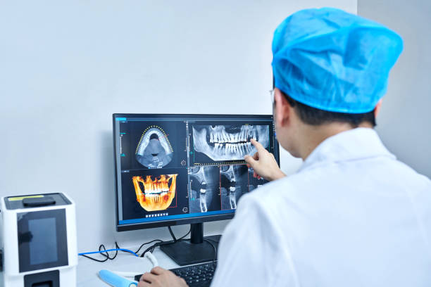 Best Emergency Tooth Extraction in Tuskegee, AL