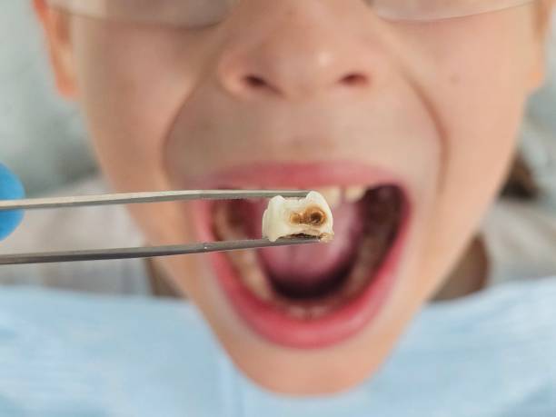 Best Emergency Dental Surgery in Tuskegee, AL